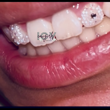 Icy Cowgirls Tooth Gems (Round)